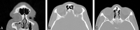 Fig 3.