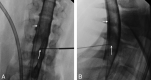 Fig 1.