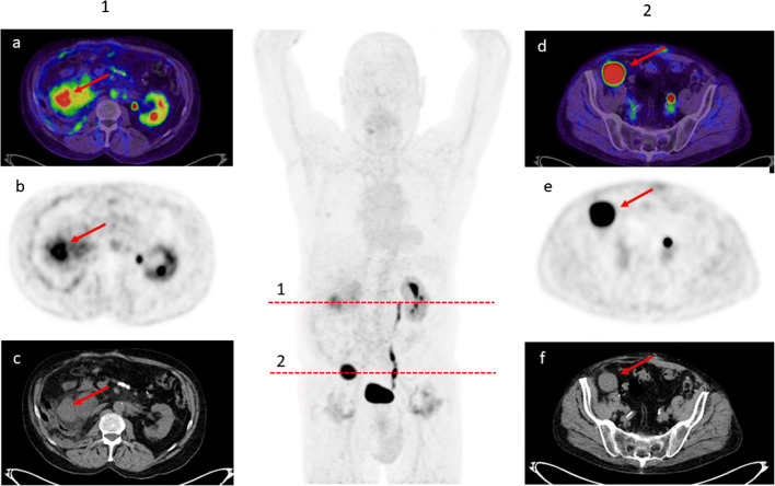 Fig. 2