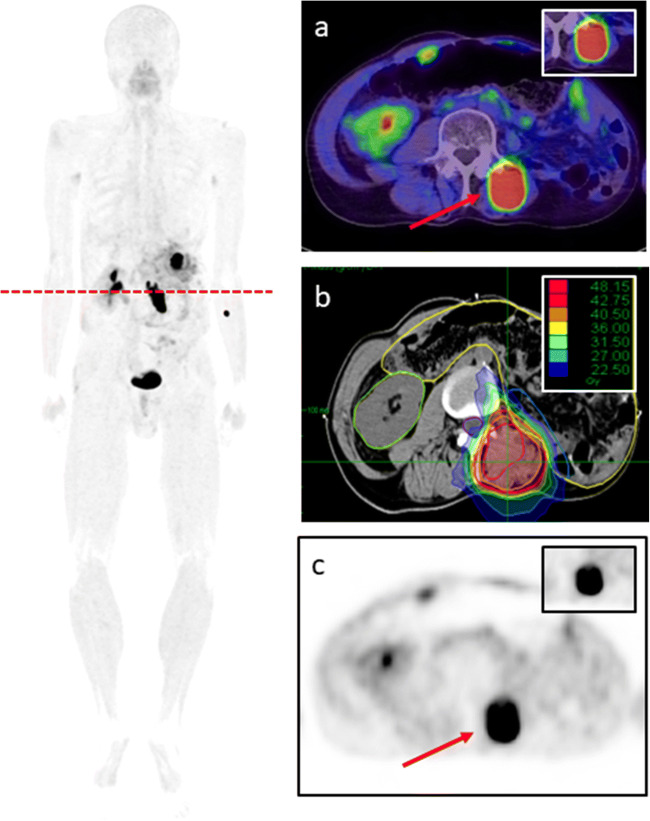 Fig. 3