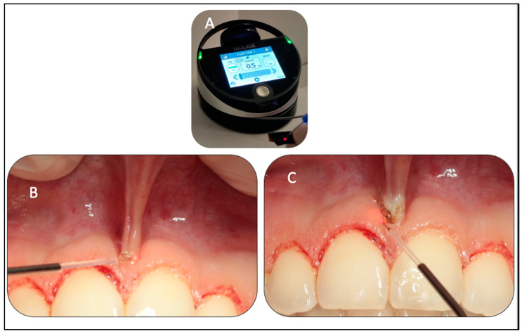 Figure 6