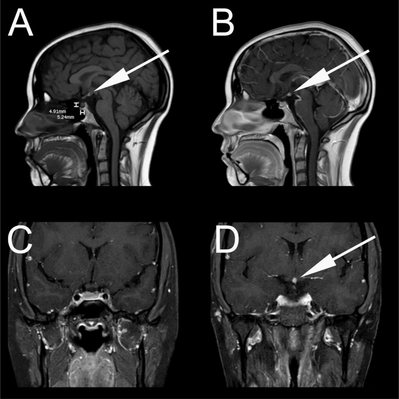 Fig. 1: