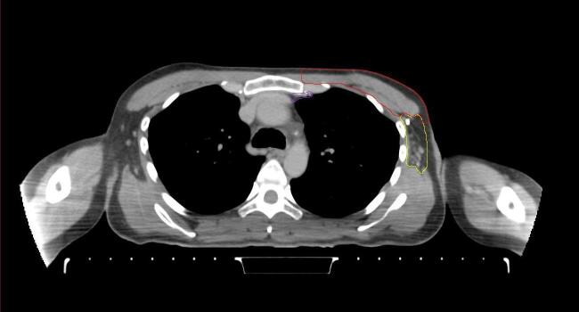 Supplementary figure 44