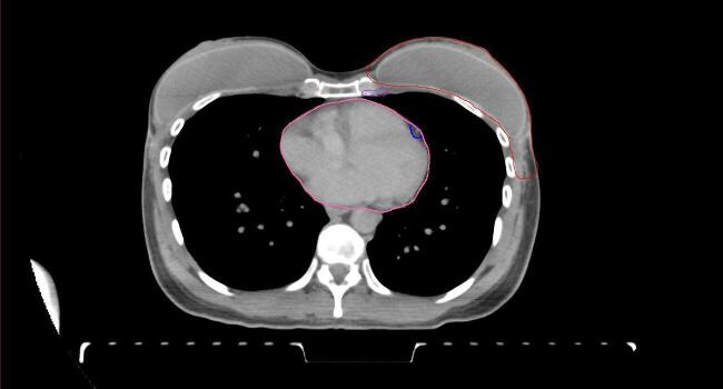 Supplementary figure 58