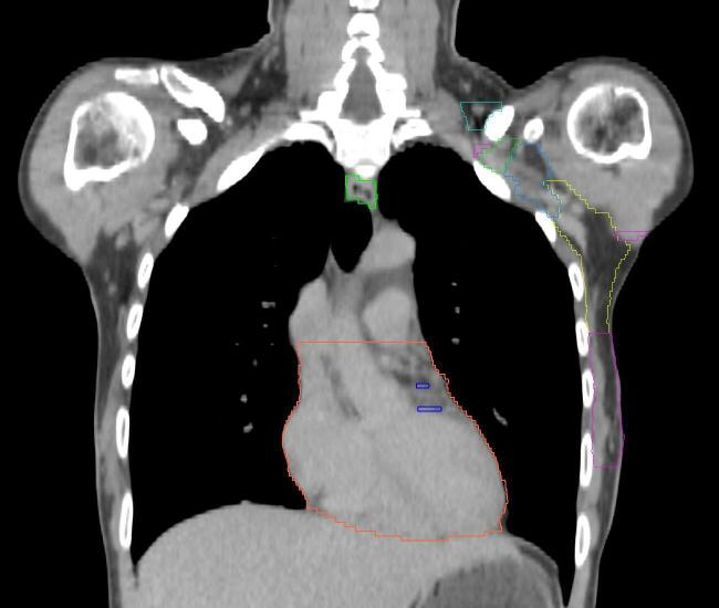 Supplementary figure 3