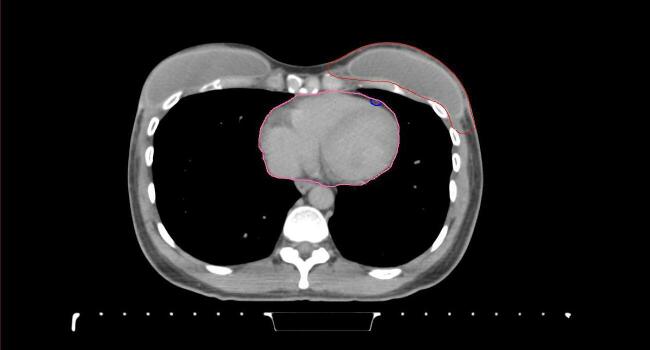 Supplementary figure 61