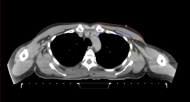 Supplementary figure 38