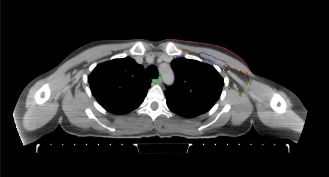 Supplementary figure 37