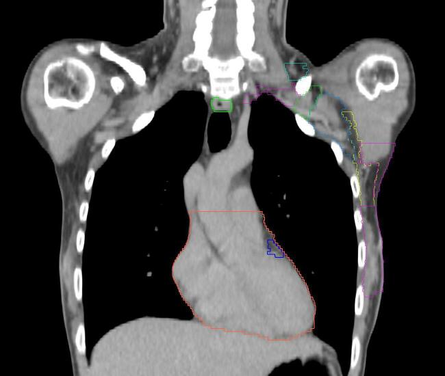 Supplementary figure 1