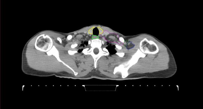 Supplementary figure 18