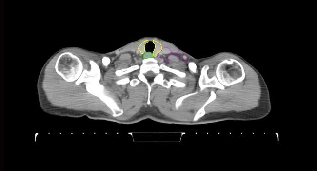 Supplementary figure 15