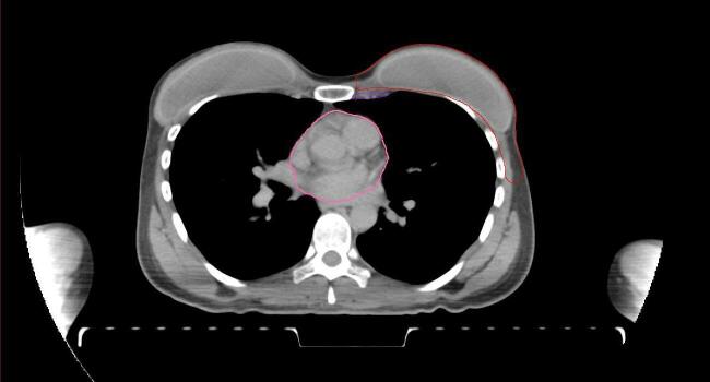 Supplementary figure 54