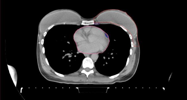 Supplementary figure 57