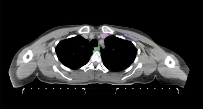 Supplementary figure 35