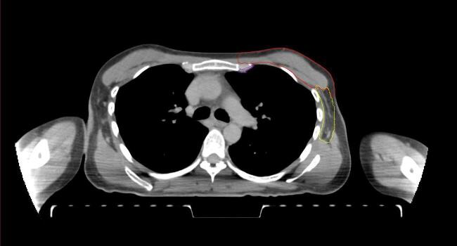 Supplementary figure 46