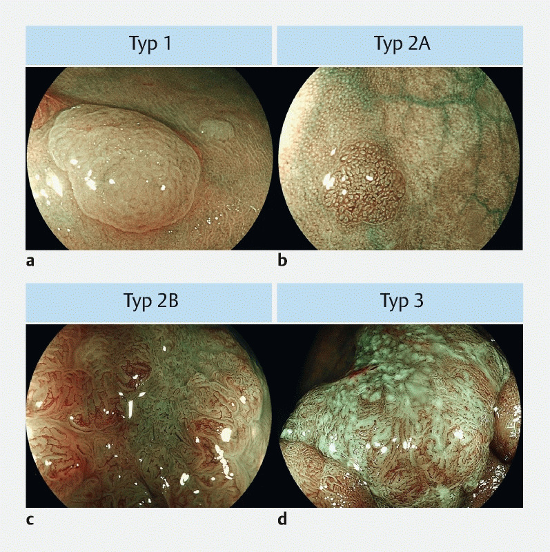 Fig. 1