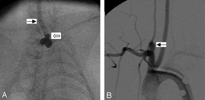 Fig 2.