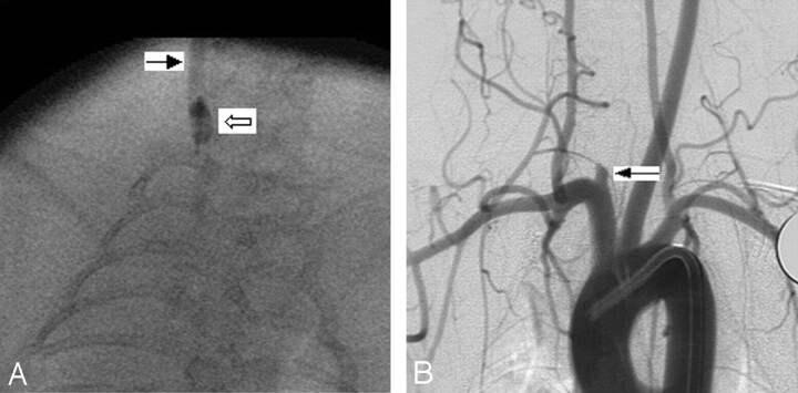 Fig 3.