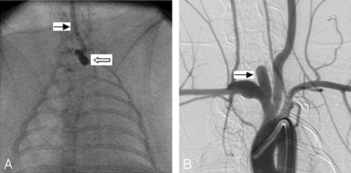 Fig 1.