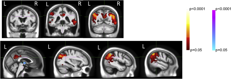 Fig. 3