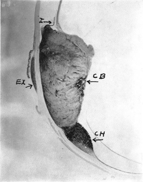 FIGURE 34