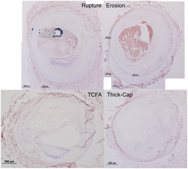 Figure 20