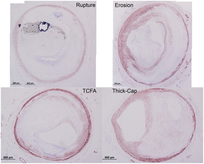 Figure 16