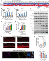 Figure 7. Birinapant and fulvestrant enhance antigen presentation, T-cell migration, and T-cell–mediated cytotoxicity. A, mRNA expression levels of IFNγ and antigen presentation–related genes in MCF7 cells that were treated with vehicle control (DMSO), fulvestrant (10 nmol/L), birinapant (100 nmol/L), and the combination of fulvestrant and birinapant for 3 days and stimulated with IFNγ for the last 24 hours. B–E, Median fluorescence intensity (MFI) quantification of MHC-I and PD-L1 levels assessed by flow cytometry in MCF7 cells grown in HD or in the presence of E2 (B and C) or treated with fulvestrant (10 nmol/L; D and E), and treated with the addition of doses of birinapant for 3 days. Cells were stimulated with IFNγ (10 ng/mL) for the last 24 hours. MFI levels are relative to no-IFNγ conditions (*, P < 0.05; ***, P< 0.001; n.s., not significant). Error bars, mean ± SD of at least two replicates. F, Whole-cell lysates immunoblots of ER, NF-KB subunits, and IFNγ target genes in MCF7 cells grown treated with vehicle control (DMSO), fulvestrant (10 nmol/L), birinapant (100 nmol/L), and the combination with and without IFNγ (10 ng/mL) stimulation for 24 hours. G, Representative immunofluorescence images from T-cell migration assay after treatment with vehicle control (DMSO), fulvestrant (10 nmol/L), birinapant (100 nmol/L), and the combination MCF7 cells were pretreated and seeded in the AIM 3D cell culture chips. Primary CD8+ T cells stained with CellTrace Red Stain were seeded on the lateral channels. H, Quantification of migration to the matrix was measured after 5 days (*, P < 0.05. Error bars are mean ± SD of at least 5 replicates. Two-way ANOVA). I, Representative figures of immunofluorescent stains of cocultured MCF7_NYESO1 and T cells transduced with NYESO1-specific TCR. Immunofluorescent stains include MHC-I (red), granzyme B (green), actin (yellow), DAPI for nuclear staining (blue), and a merged image. J, MCF7 cells expressing specific NYESO1 antigen were pretreated with vehicle (DMSO), fulvestrant (10 nmol/L), birinapant (100 nmol/L), and the combination of both drugs and cocultured with primary NYESO1 TCR+ T cells for 16 hours. The number of cancer cells alive was measured, and data are relative to MCF7_NYESO1 grown without T cells. *, P < 0.05; ***, P < 0.001; n.s., not significant. Error bars are mean ± SD of at least three replicates. Two-way ANOVA.