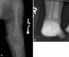 Fig. 2A–B