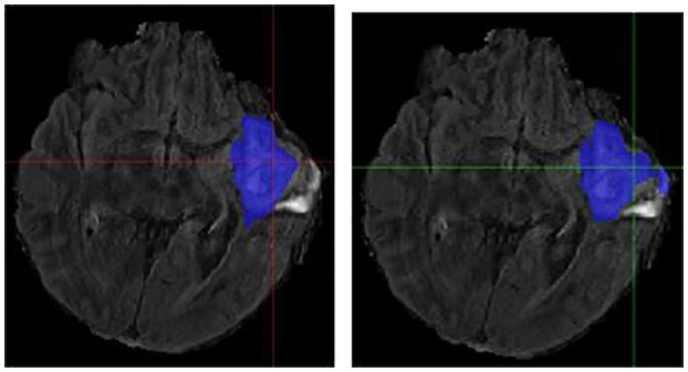 Figure 6