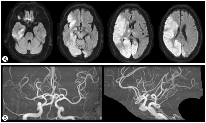 Fig. 3