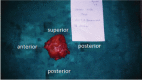 [Table/Fig-3]: