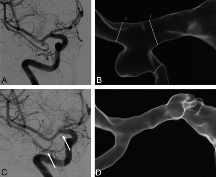 Fig 4.