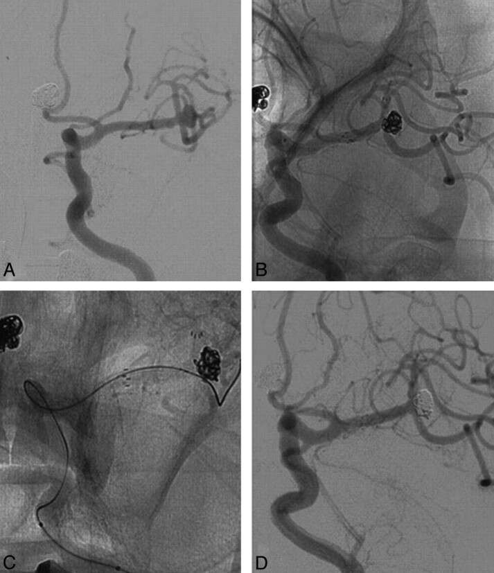 Fig 3.