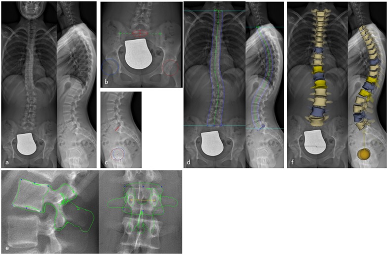 Fig 1