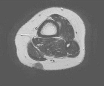 Fig. 7