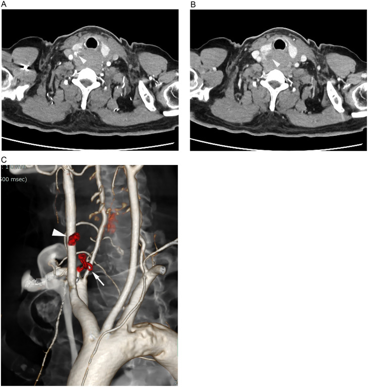 Fig 2