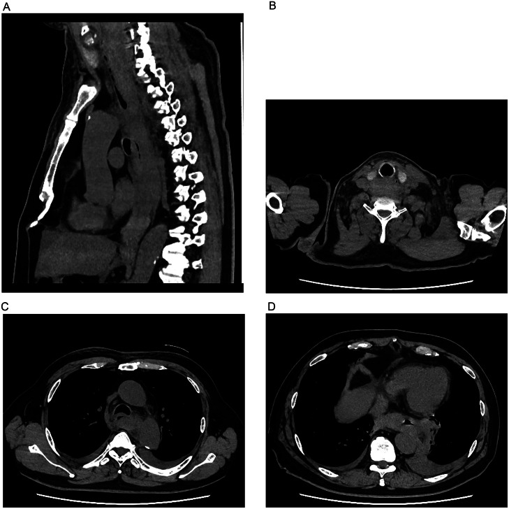 Fig 1