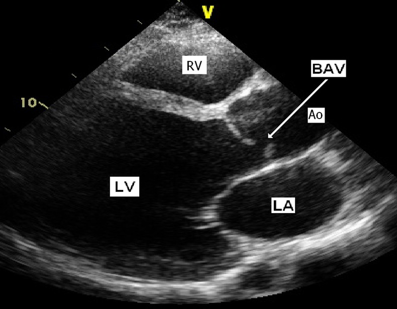 Figure 2