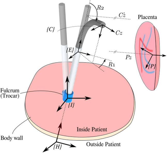 Fig. 2