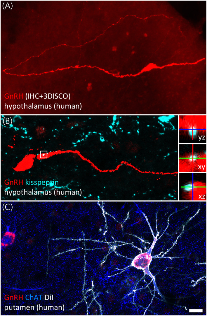 FIGURE 3