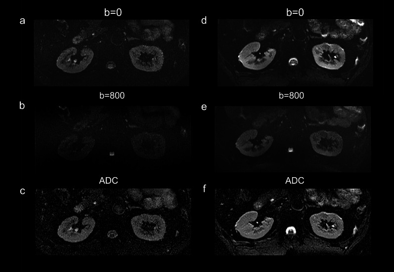 Renal imaging at 5 T versus 3 T: a comparison study - PMC