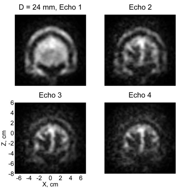 Fig. 4