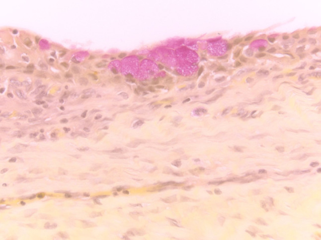 Fig. 3