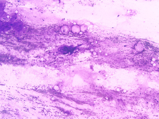 Fig. 4