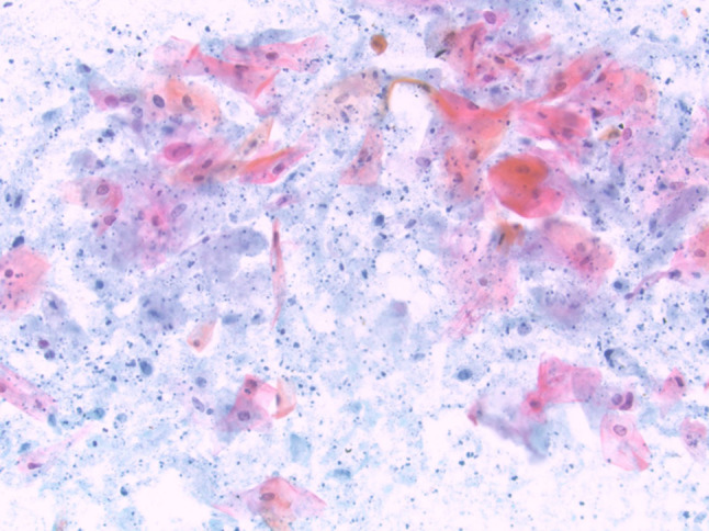 Fig. 16