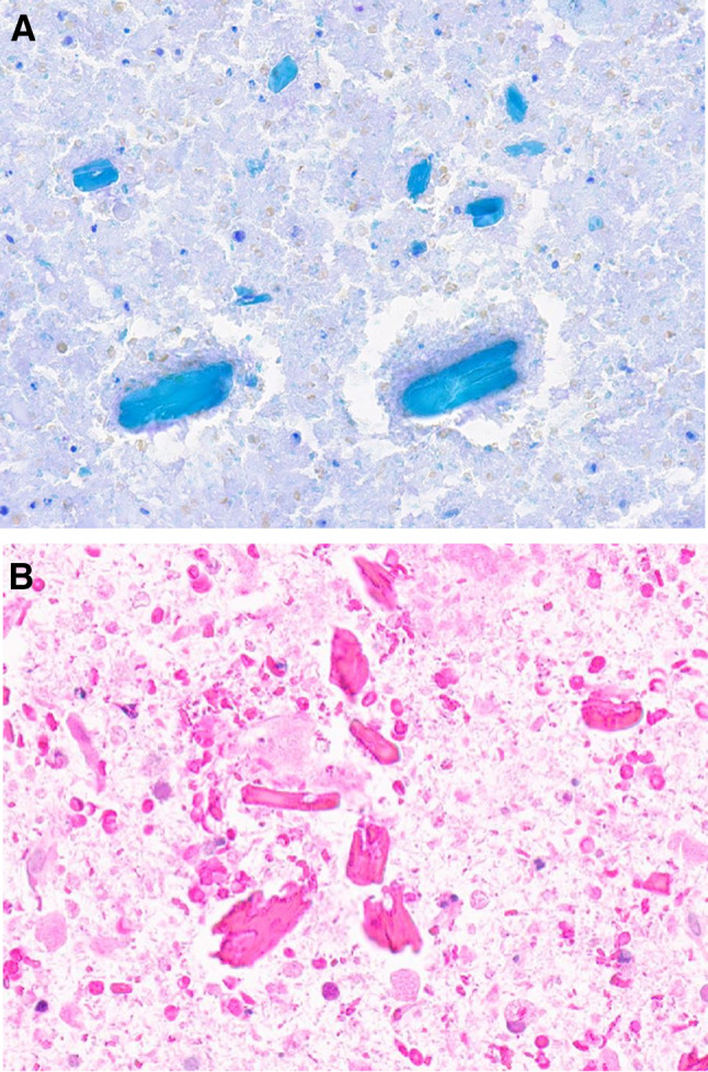Fig. 11