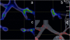 Fig. 12