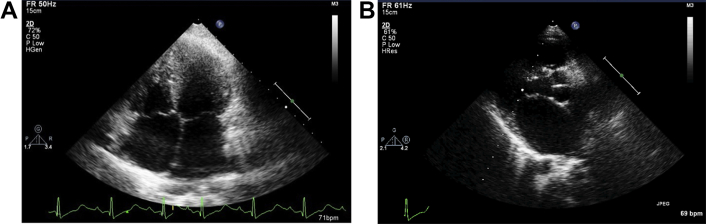 Fig. 3