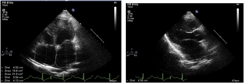 Fig. 4